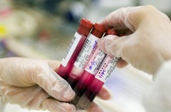Blood Check Exhibits Promise for Alzheimer’s Analysis